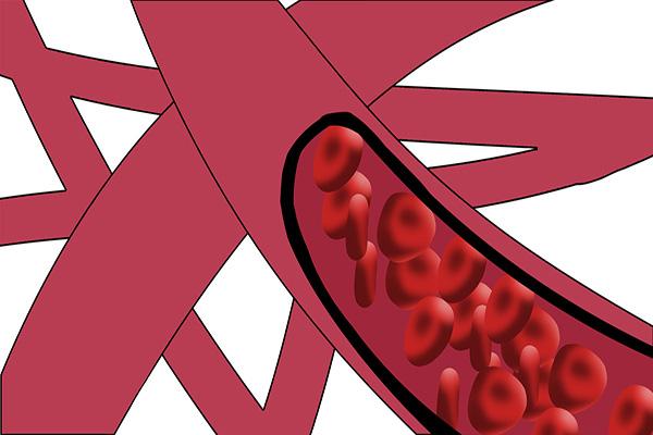 每天的两个时间，血液易“缺水”，此时饮水，有助预防血管疾病