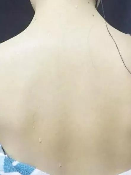 身体乳和尿素软膏