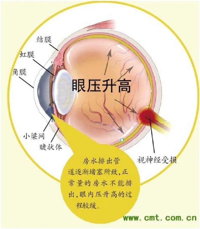 孩子总说眼睛疼，怎么缓解