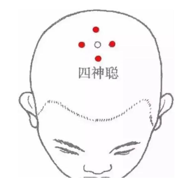 促进睡眠，远离心脑血管疾病的“特效穴”每天按一按