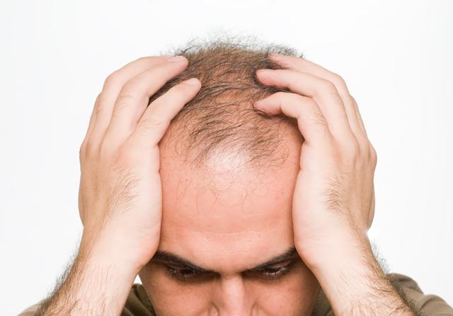 男人临事不起，胸闷气短，脱发严重怎么办？中医一方帮你恢复