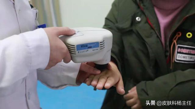 皮肤科皮损取材检查是什么意思