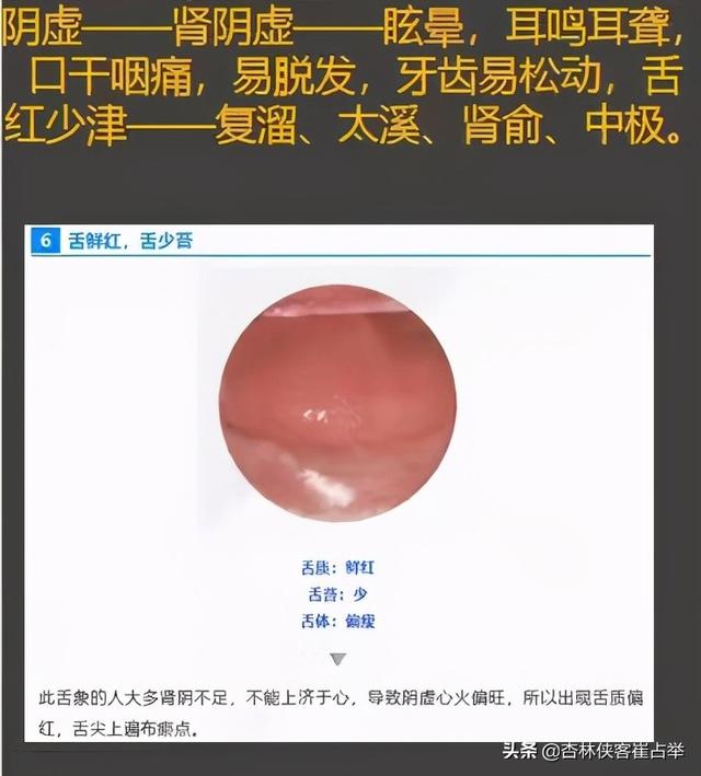 肺气虚、心阴虚、脾气虚，动一动就出汗怎么办？中医：治汗六法