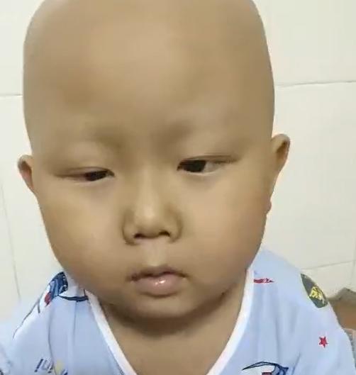 化疗见效慢，广西夫妻带孩子做针灸，结果却不尽人意