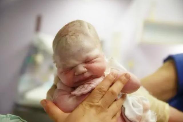 同是孕晚期，孕38周和孕40周分娩的娃无差别？三个方面区别很明显