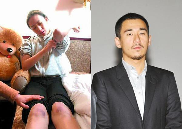 黄定宇控制童瑶近一年:“小章子怡”童瑶：和章子怡同脸不同命，被强奸被家暴她有何苦衷
