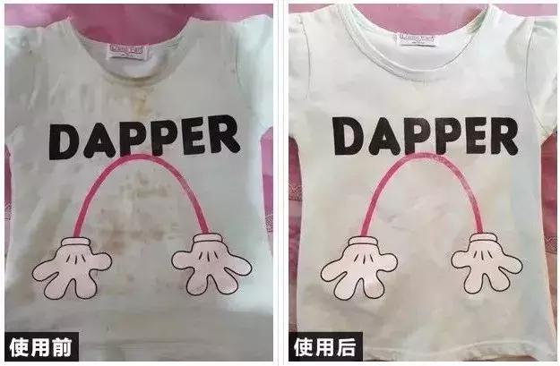 胸罩磨皮肤怎么办