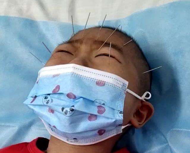 化疗见效慢，广西夫妻带孩子做针灸，结果却不尽人意
