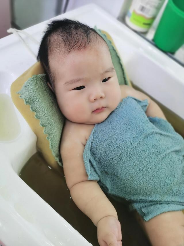 宝妈看在眼里，疼在心上，婴儿身体褶皱处发红甚至皮肤破损