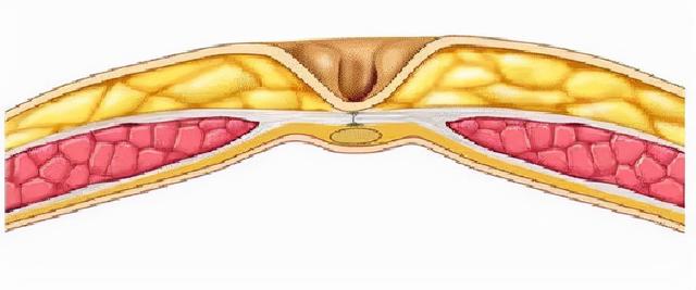 肚脐眼后面通向哪里？| 趣问万物