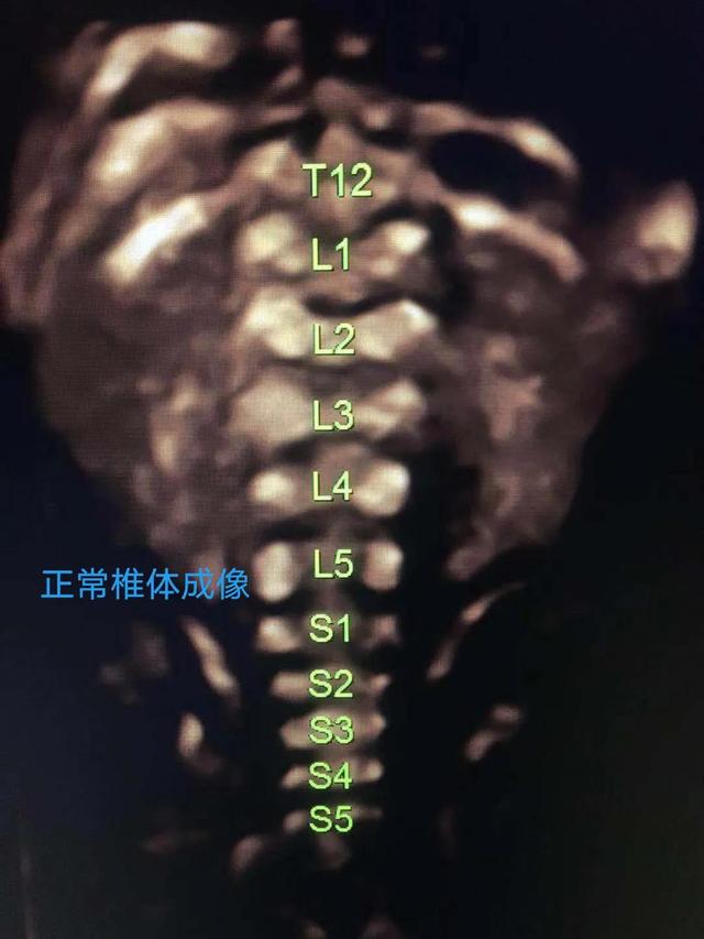 你也能看懂的胎儿畸形——病例分享