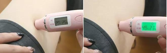 涂身体乳很痛怎么回事