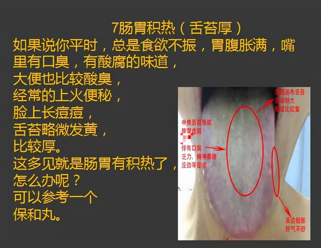 齿痕重是脾虚，舌苔厚也是脾虚吗？怎样把舌苔变薄、齿痕消失呢？