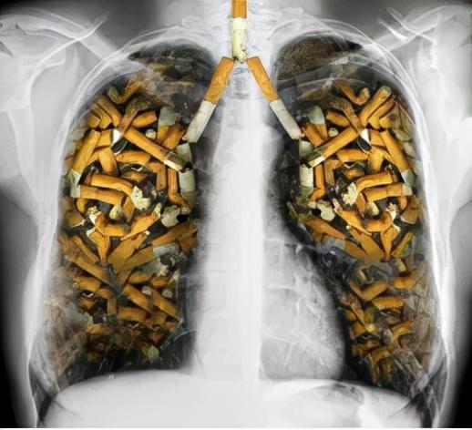 大咖谈：治愈早期肺癌快过感冒，筛查是关键