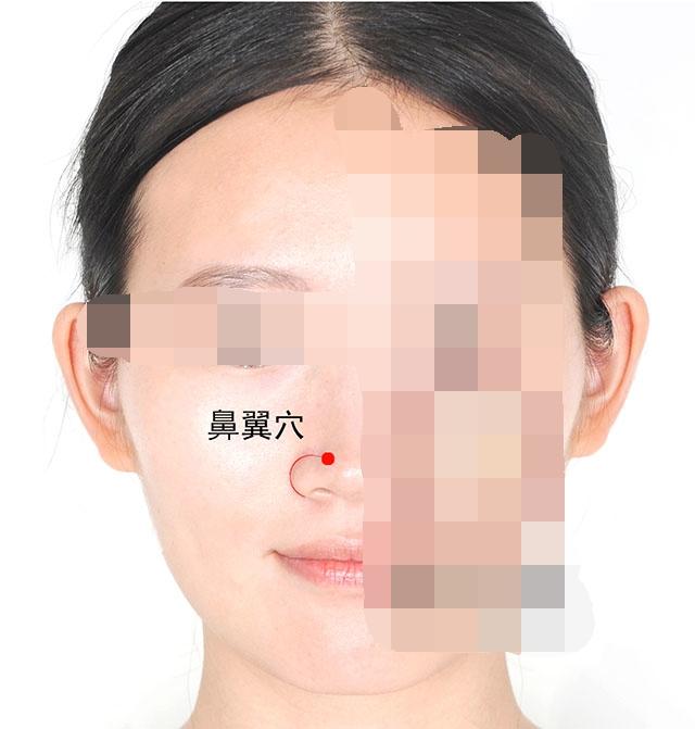 中医针灸鼻腔疾病处方1