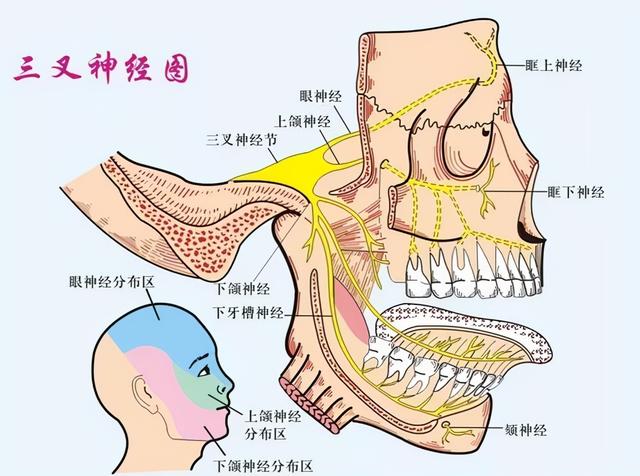 “风吹草动”皆可引发这种剧痛——得了三叉神经痛千万不要再忍了