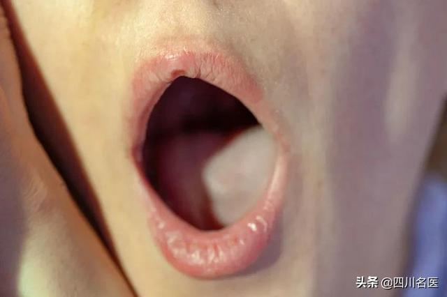 女子做核酸检测，意外发现舌部肿块u2026医生：这癌恶性程度高、生长快- 全网搜