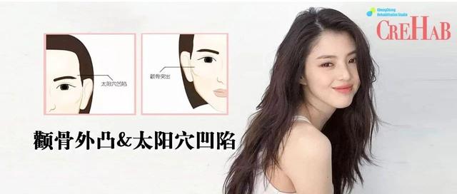 颧骨突出怎么办