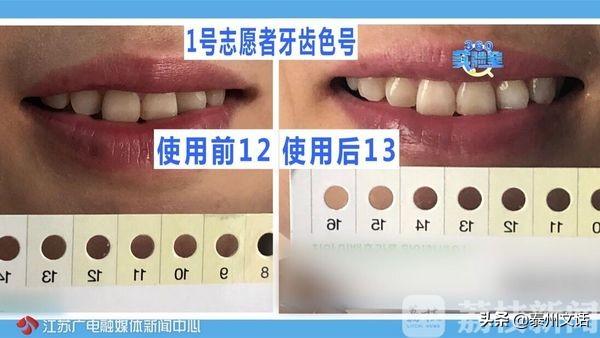 白牙素