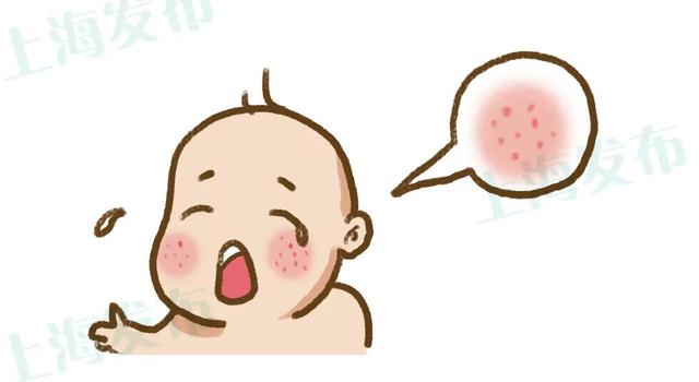 角化湿疹能用黄皮肤软膏吗