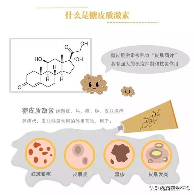 角化型脚气可以撕皮吗