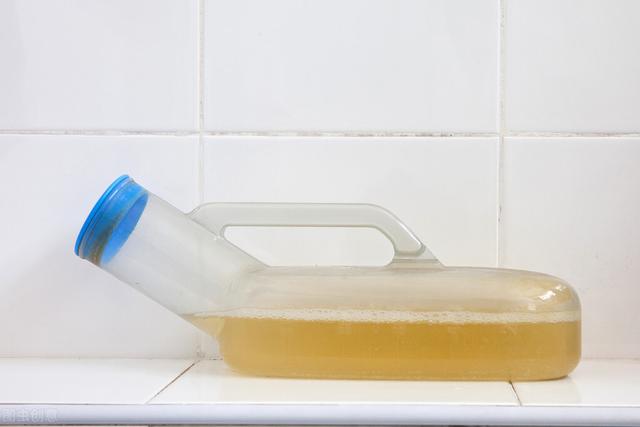 肾病肌酐升高后，尿量减少怎么办？2个方法可改善更护肾