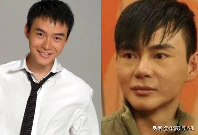 侣皓喆:明星大型“翻车”现场，她们是如何整容变毁容的
