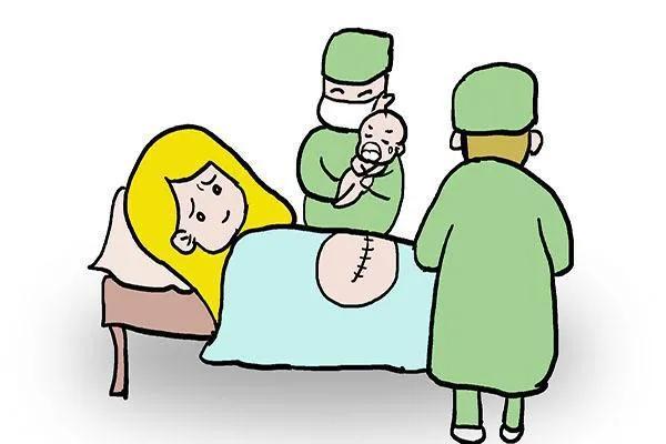 剖腹产是种什么体验？回顾自己从怀孕到剖腹产的经历