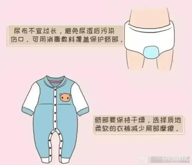 新生宝宝脐带不会护理怎么办？看这里