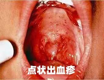 脖子皮肤像鸡皮是hpv吗