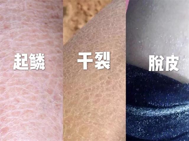 皮肤修护身体乳
