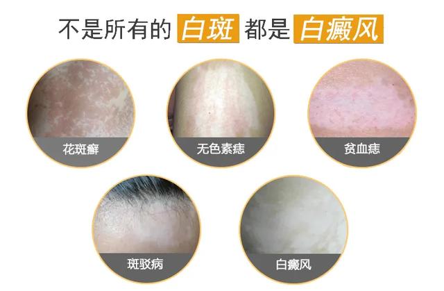 四岁宝宝肚子上有白点像鸡皮肤