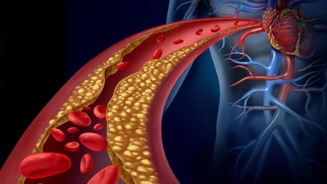 吃肉的人和吃素的人，哪种更容易得心血管疾病？均衡营养才是关键