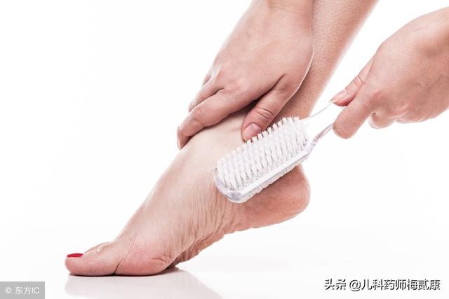 角化型手足癣可以冷冻治疗吗