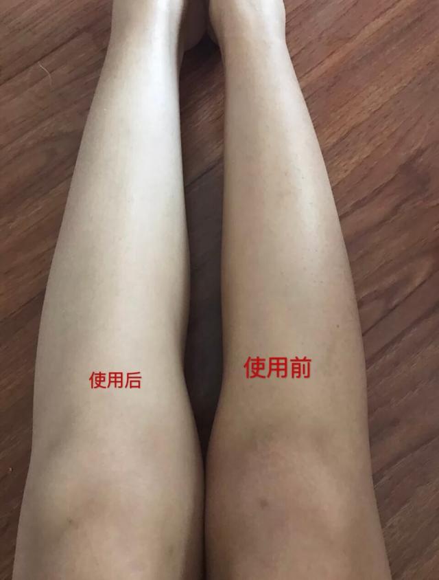 青春痘可以涂磨砂膏和身体乳吗