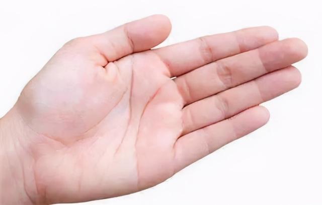 手脱皮怎么治疗好（手上老是脱皮怎么办）