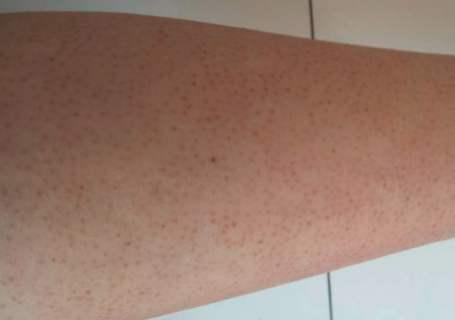 每天擦身体乳知乎