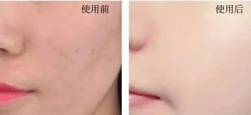 女生清纯什么意思