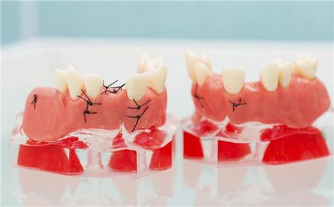 专家提醒！戴假牙的4大禁忌，很多人经常做