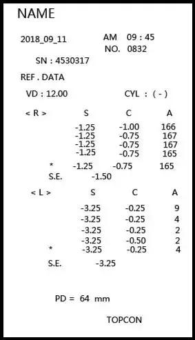 视力检查单子s.e什么意思