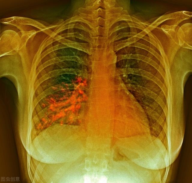 如何预防老年人呛咳？