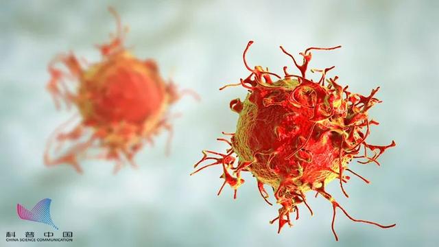 皮肤角化珠图片