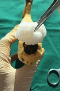 宝宝冬天起鸡皮肤