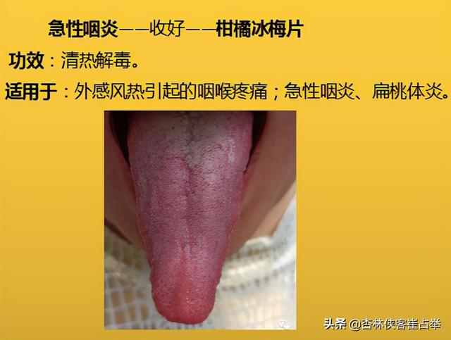 咽炎、高脂血症，四肢麻木，10个中成药，年过35岁后要收藏备好