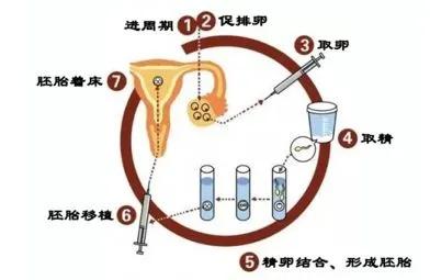 第三代试管婴儿优势多成功率高，但费用也高，并不是人人都适合做