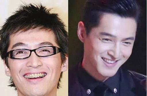 高圆圆整牙之前模样高圆圆没整牙以前照片