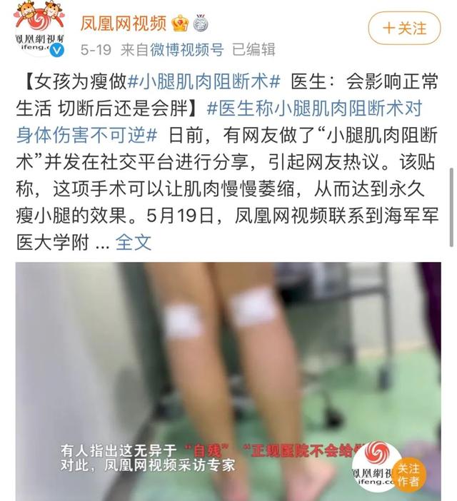 断骨增高 断肌瘦腿 现代人为了 美 有多拼 全网搜