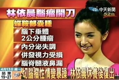 “拼命三娘”林依晨怀孕：嫁入豪门7年后，她改写了自己的结局