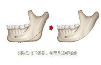 发腮是什么意思