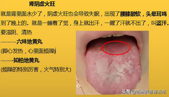 治疗失眠的中成药大总结，失眠、多梦、入睡困难再也不怕用错药